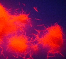 άӫ5mm